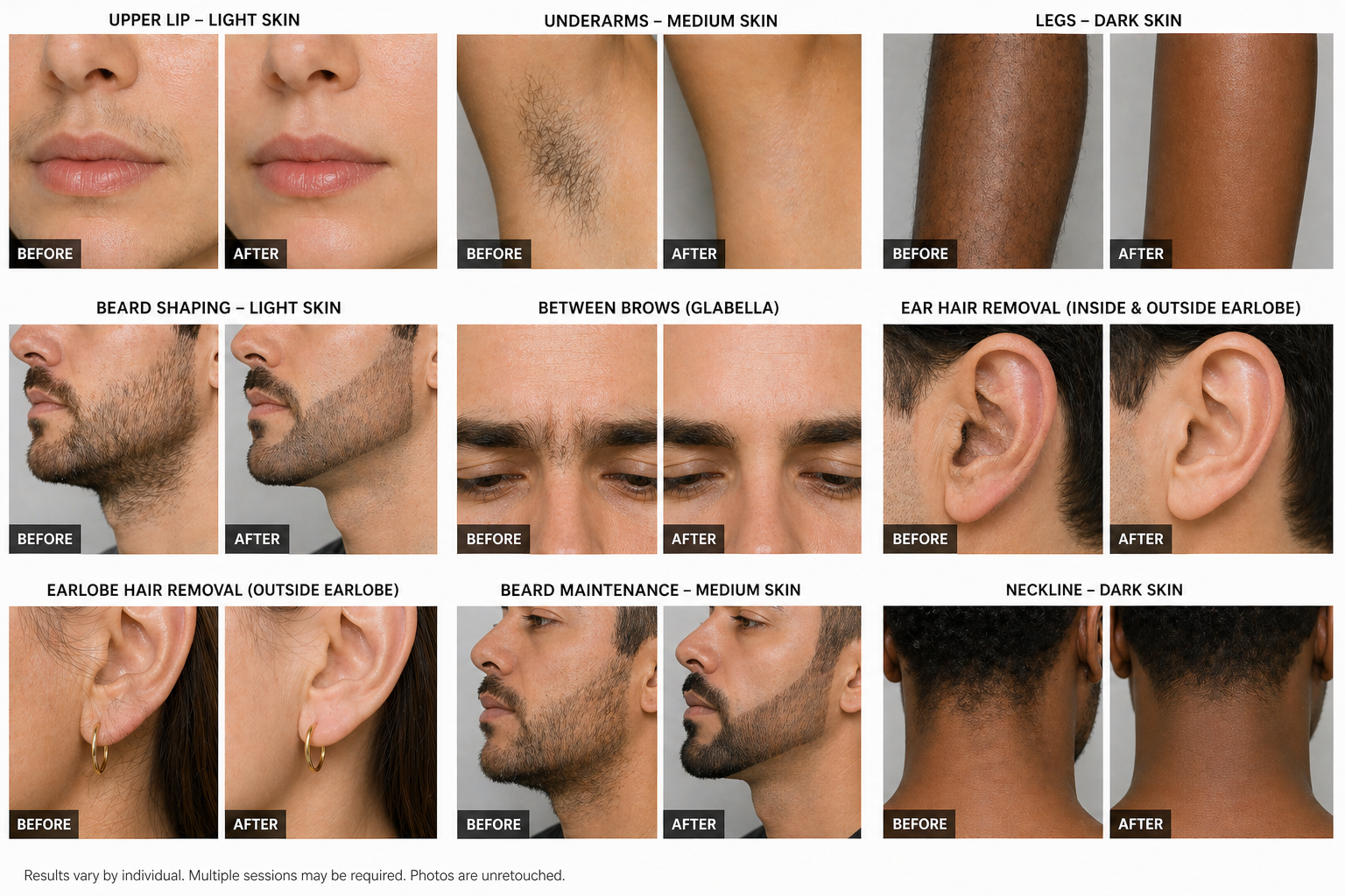 Laser treatments before and after results in Carrollton, TX