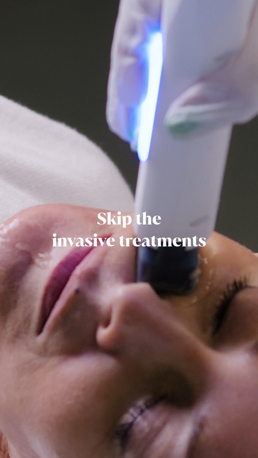 XERF treatment experience at St Marys in Carrollton